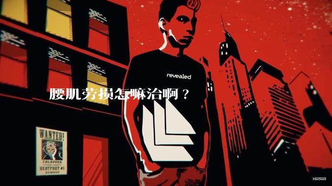 腰肌劳损怎嘛治啊?